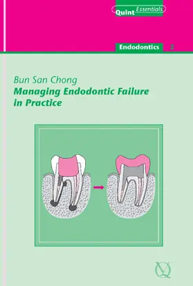 Chong |  Managing Endodontic Failure in Practice | eBook | Sack Fachmedien