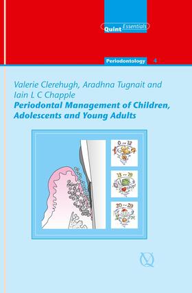 Clerehugh / Tugnait / Chapple |  Periodontal Management of Children, Adolescents and Young Adults | eBook | Sack Fachmedien