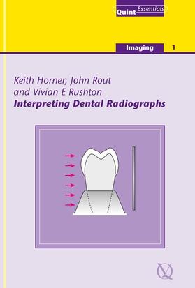 Horner / Rout / Rushton | Interpreting Dental Radiographs | E-Book | sack.de