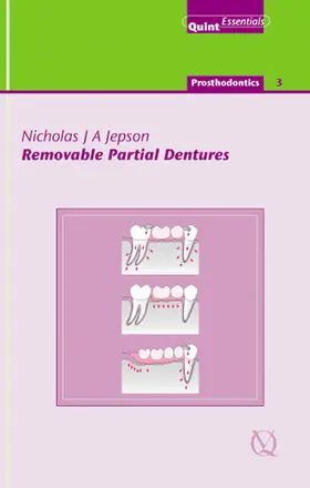 Jepson |  Removable Partial Dentures | eBook | Sack Fachmedien