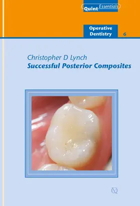 Lynch |  Successful Posterior Composites | eBook | Sack Fachmedien