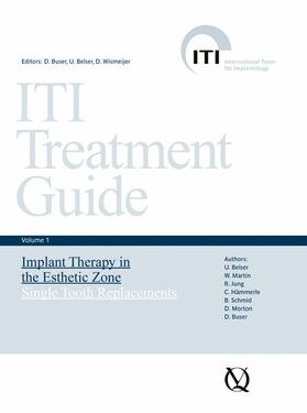 Buser / Belser / Wismeijer | Implant Therapy in the Esthetic Zone | E-Book | sack.de