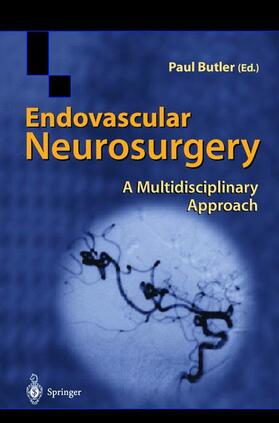 Butler | Endovascular Neurosurgery | Buch | 978-1-85233-620-2 | sack.de