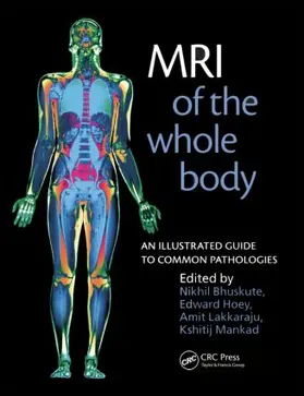 Bhuskute / Hoey / Lakkaraju | MRI of the Whole Body | Buch | 978-1-85315-776-9 | www.sack.de