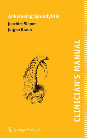 Braun / Sieper | Clinician's Manual on Ankylosing Spondylitis | Buch | 978-1-85873-436-1 | sack.de