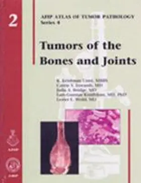 Unni |  Tumors of the Bones and Joints | Buch |  Sack Fachmedien
