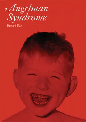 Dan |  Angelman Syndrome | Buch |  Sack Fachmedien