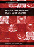 Govaert / de Vries |  An Atlas of Neonatal Brain Sonography | Buch |  Sack Fachmedien