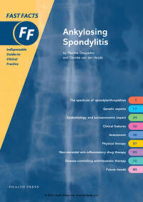 van der Heijde | Fast Facts: Ankylosing Spondylitis | Buch | 978-1-903734-44-5 | sack.de
