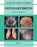 Jones / Doherty |  Oesteoarthritis | Buch |  Sack Fachmedien
