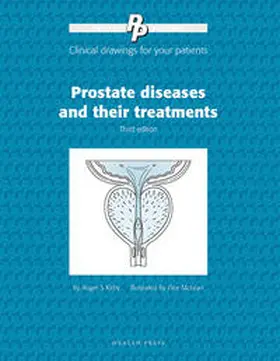Kirby |  Patient Pictures: Prostate Diseases and their Treatments | Buch |  Sack Fachmedien