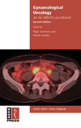 Acheson / Luesley |  Gynaecological Oncology for the Mrcog and Beyond | Buch |  Sack Fachmedien