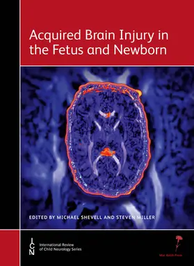 Shevell / Miller |  Acquired Brain Injury in the Fetus and Newborn | Buch |  Sack Fachmedien
