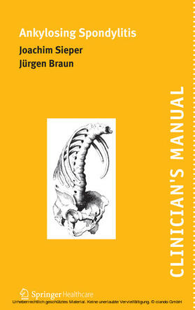 Sieper / Braun | Clinician's Manual on Ankylosing Spondylitis | E-Book | sack.de