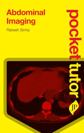 Sinha |  Pocket Tutor Abdominal Imaging | Buch |  Sack Fachmedien