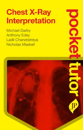 Darby | Pocket Tutor Chest X-Ray Interpretation | Buch | 978-1-907816-06-2 | sack.de