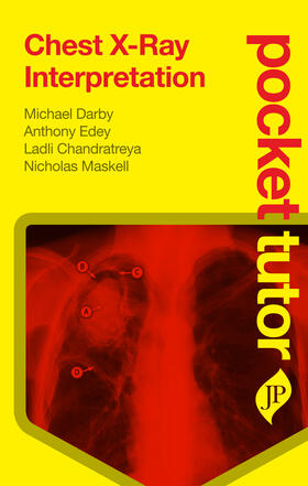 Darby | Darby, M: Pocket Tutor Chest X-Ray Interpretation | Buch | 978-1-907816-06-2 | sack.de
