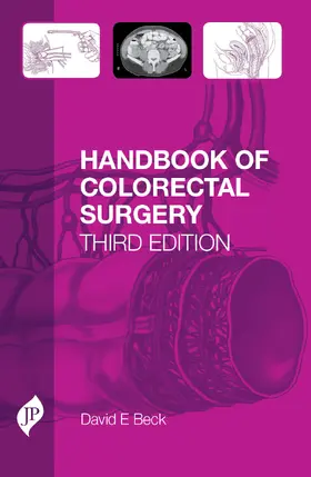 Beck |  Handbook of Colorectal Surgery | Buch |  Sack Fachmedien