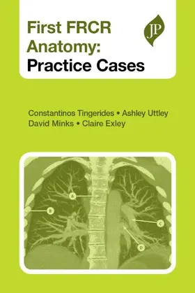 Tingerides | First FRCR Anatomy | Buch | 978-1-907816-37-6 | www.sack.de