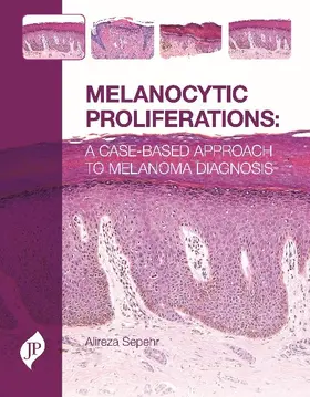 Sepehr / Chan |  Melanocytic Proliferations | Buch |  Sack Fachmedien