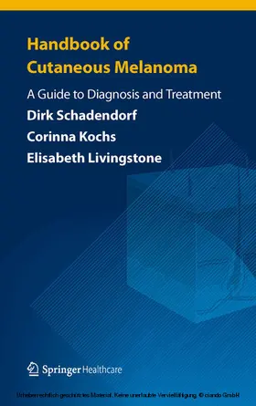 Schadendorf / Kochs / Livingstone |  Handbook of Cutaneous Melanoma | eBook | Sack Fachmedien