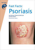 Menter / Smith / Barker |  Fast Facts: Psoriasis | Buch |  Sack Fachmedien