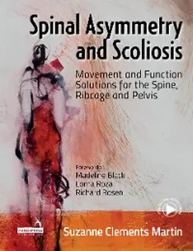 Martin |  Spinal Asymmetry and Scoliosis | eBook | Sack Fachmedien