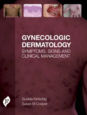 Kirtschig / Cooper |  Gynecologic Dermatology | Buch |  Sack Fachmedien