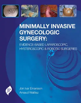 Wattiez / Einarsson |  Minimally Invasive Gynecologic Surgery: Evidence-Based Laparoscopic, Hysteroscopic & Robotic Surgeries | Buch |  Sack Fachmedien