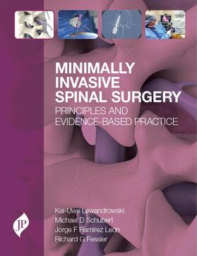 Lewandrowski / Schubert / Ramirez |  Minimally Invasive Spinal Surgery | Buch |  Sack Fachmedien