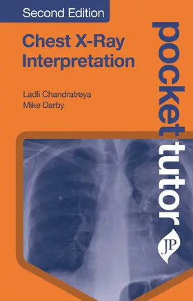 Chandratreya / Darby | Pocket Tutor Chest X-Ray Interpretation | Buch | 978-1-909836-86-0 | sack.de