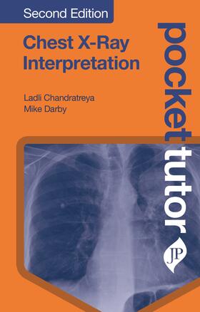 Chandratreya / Darby | Chandratreya, L: Pocket Tutor Chest X-Ray Interpretation | Buch | 978-1-909836-86-0 | sack.de