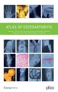Arden / Hayashi / Blanco |  Atlas of Osteoarthritis | Buch |  Sack Fachmedien