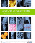 Arden / Blanco / Cooper |  Atlas of Osteoarthritis | eBook | Sack Fachmedien