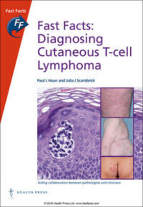 Haun / Scarisbrick | Fast Facts: Diagnosing Cutaneous T-Cell Lymphoma | Buch | 978-1-910797-20-4 | sack.de