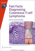 Haun / Scarisbrick |  Fast Facts: Diagnosing Cutaneous T-Cell Lymphoma | Buch |  Sack Fachmedien