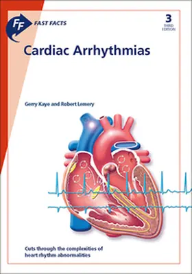 Kaye / Lemery |  Fast Facts: Cardiac Arrhythmias | Buch |  Sack Fachmedien