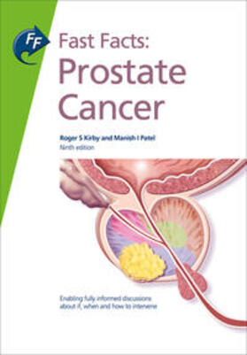 Kirby / Patel | Fast Facts: Prostate Cancer | Buch | 978-1-910797-37-2 | sack.de