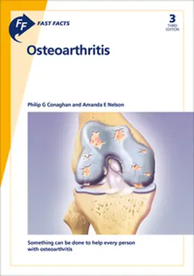 Conaghan / Nelson |  Fast Facts: Osteoarthritis | Buch |  Sack Fachmedien