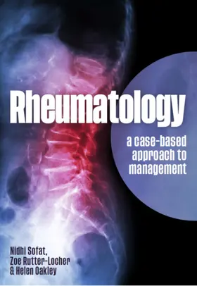 Sofat / Rutter-Locher / Oakley |  Rheumatology | Buch |  Sack Fachmedien