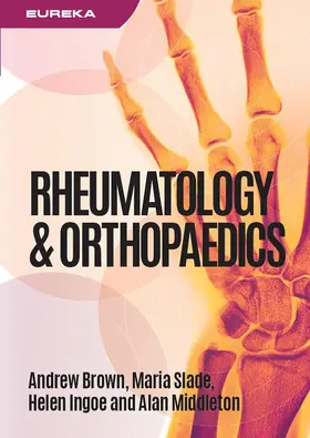 Brown / Slade / Ingoe |  Eureka: Rheumatology and Orthopaedics | Buch |  Sack Fachmedien