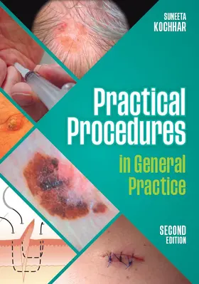 Kochhar |  Practical Procedures in General Practice, second edition | Buch |  Sack Fachmedien