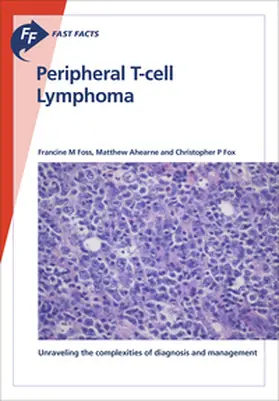 Foss / Ahearne / Fox |  Fast Facts: Peripheral T-cell Lymphoma | Buch |  Sack Fachmedien