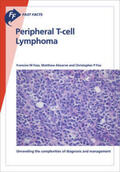 Foss / Ahearne / Fox |  Fast Facts: Peripheral T-cell Lymphoma | Buch |  Sack Fachmedien