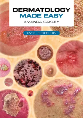 Oakley | Dermatology Made Easy, Second Edition | Buch | 978-1-914961-16-8 | www.sack.de