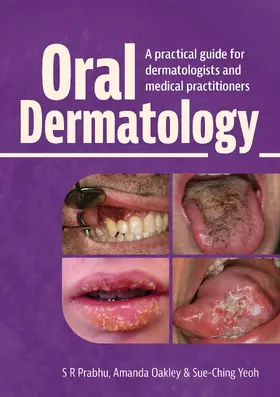 Prabhu / Oakley / Yeoh | Oral Dermatology | Buch | 978-1-914961-41-0 | www.sack.de