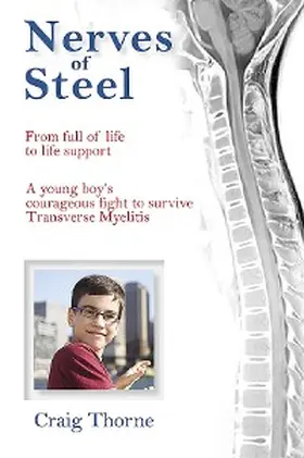 Thorne |  Nerves of Steel | eBook | Sack Fachmedien