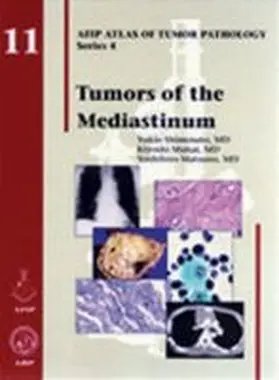 Shimosato |  Tumors of the Mediastinum | Buch |  Sack Fachmedien