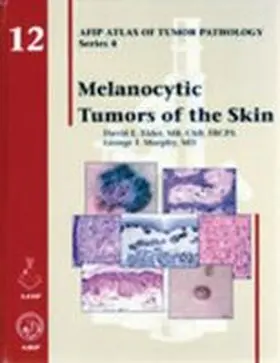 Elder |  Melanocytic Tumors of the Skin | Buch |  Sack Fachmedien