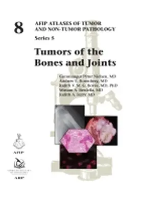 Rosenberg / Nielsen / Ferry |  Tumors of the Bones and Joints | Buch |  Sack Fachmedien